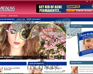 Best Done for You Acne Blog