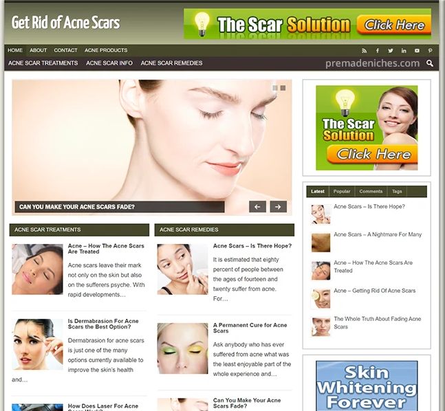 Done for You Acne Scar Treatment Website
