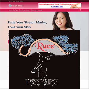 Ready Made Stretch Mark Treatment Website Template