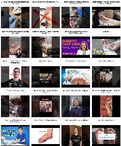 Foot Care Instant Mobile Video Site